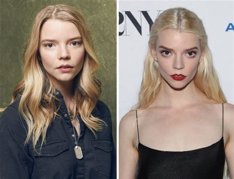 anya joy taylor plastic surgery|anya taylor joy before after.